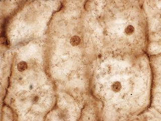 fern under a microscope