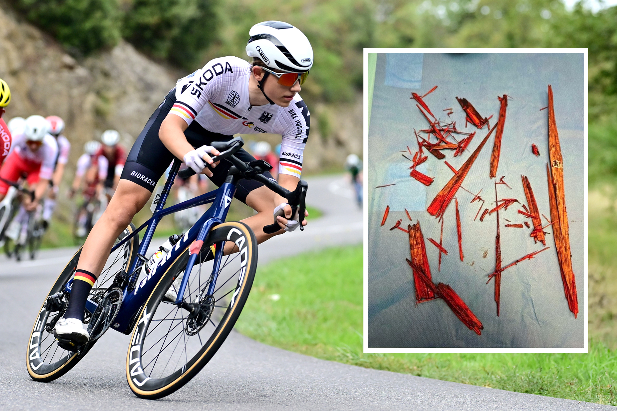 18-year-old German racer Moritz Mauss suffered a scary injury following a crash on the track at the weekend