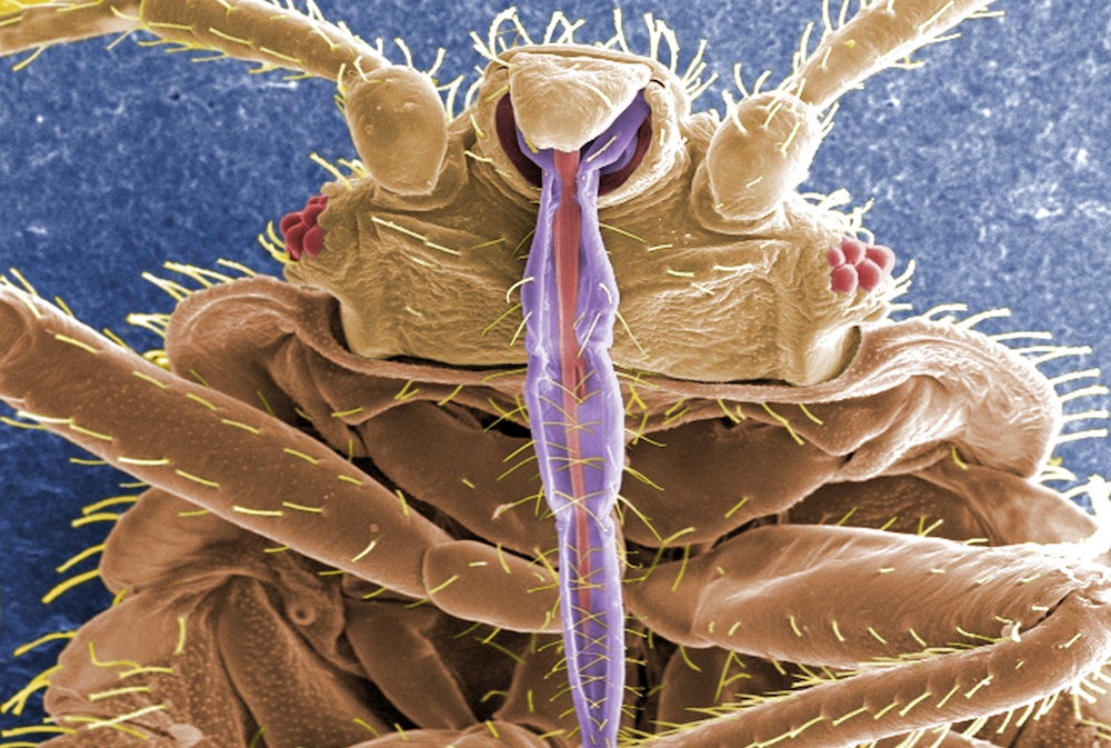 bugs found in human hair