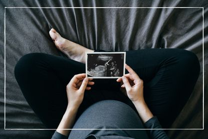 aerial shot of a pregnant woman on a bed holding a sonogram picture