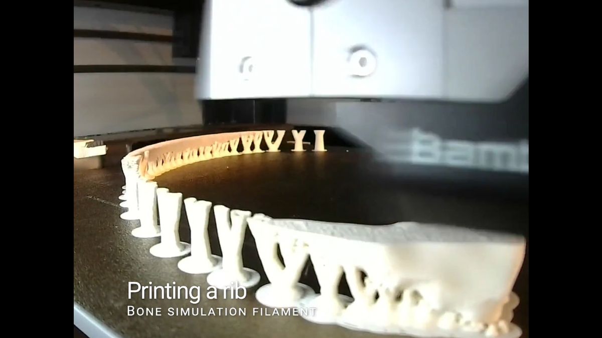 photo of 3D printer 'bone filament' simulates real bones, helps surgeons practice operations image