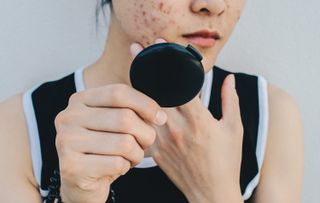 woman inspecting acne in compact mirror