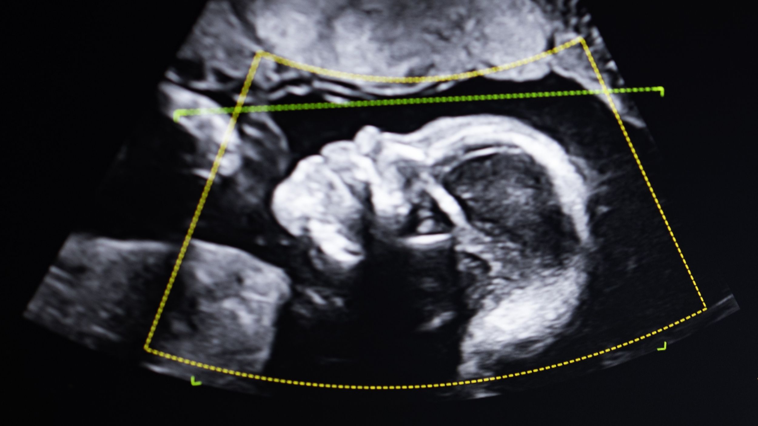 ‘It doesn’t lie. So who are you?’: What happens when DNA tests show a woman is not the mother of the child she gave birth to? ‘It doesn’t lie. So who are you?’: What happens when DNA tests show a woman is not the mother of the child she gave birth to?