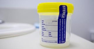 Urine Specimen