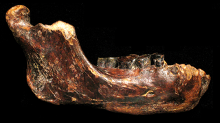 Photo of the right side of a lower jawbone (mandible). It is reddish brown and has several blackened teeth.