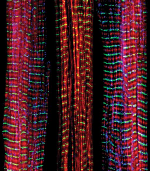 muscle fibers require the Nebulin protein to develop correctly 
