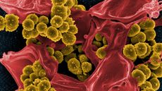 Micrograph of methicillin-resistant staphylococcus aureus (mrsa), a bacterium with circular cells