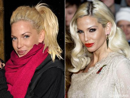 Sarah Harding - Sarah Harding brands lip fillers ?a big mistake? - Sarah Harding lip fillers - Marie Claire - Marie Claire UK