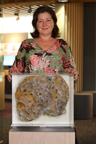 Fiona Murray, a kidney and liver recipient, donated her polycystic liver to The University of Queensland.