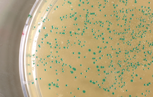 Antibiotics in Petri dish
