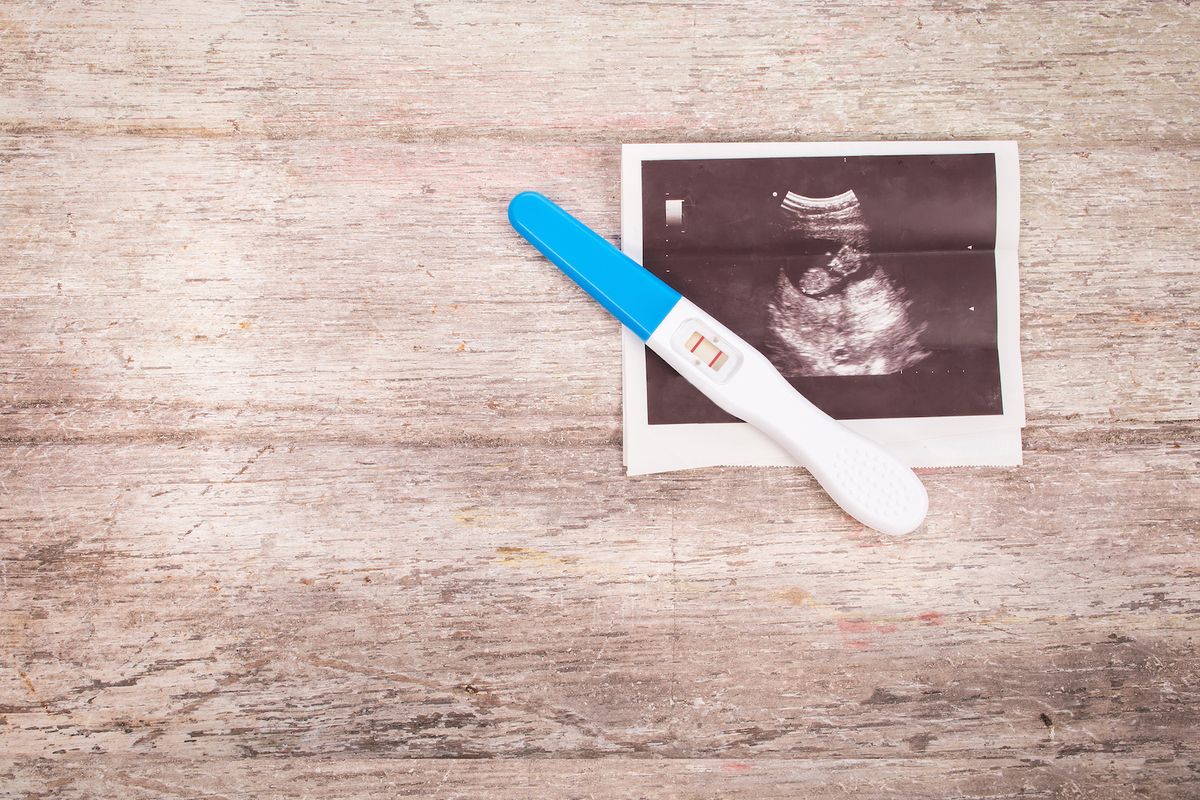 Mujer da a luz a gemelos concebidos con tres semanas de diferencia