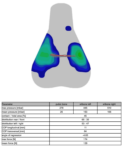 A visual output of saddle pressure mapping