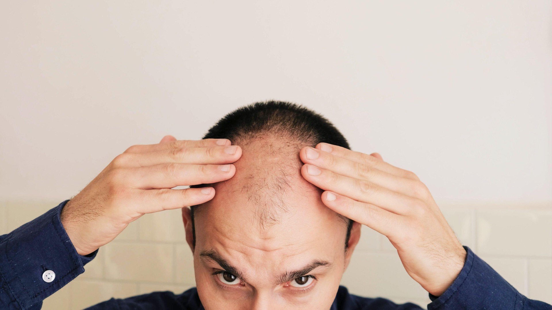 Effective Hair Fall Solutions For Men