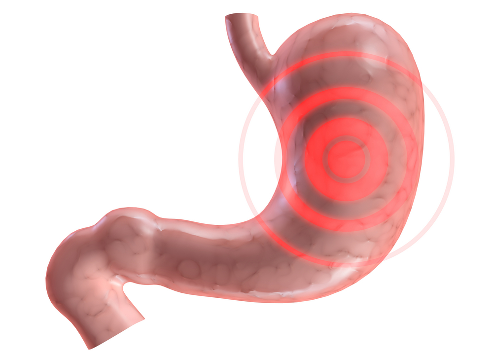 An illustration of a stomach