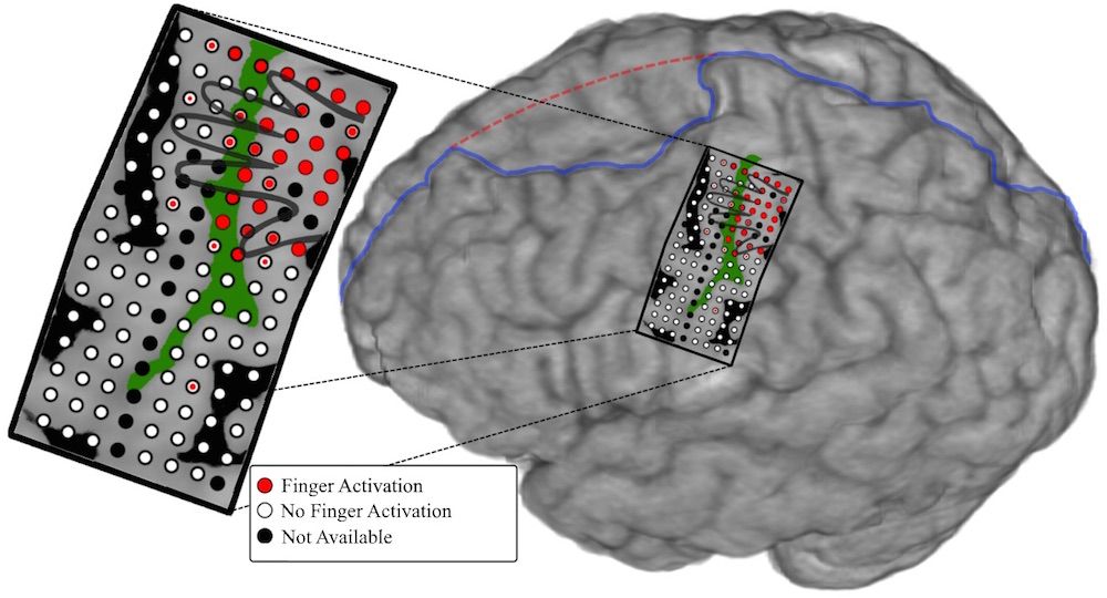 mind-reading electrodes