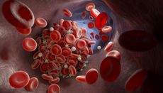Illustration of a blood clot.