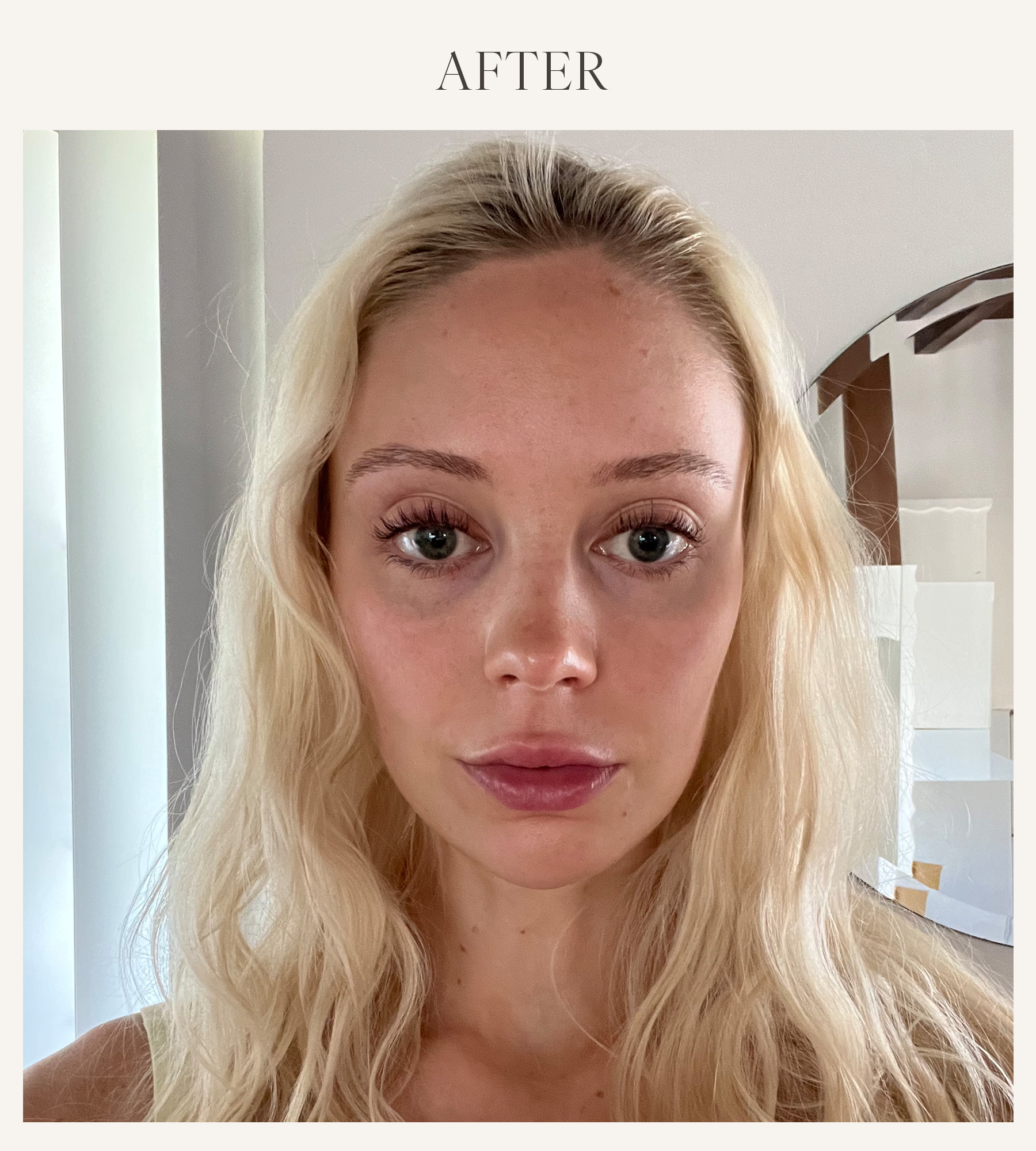 After photo of Erin Jahns testing the KNC lip plumping mask