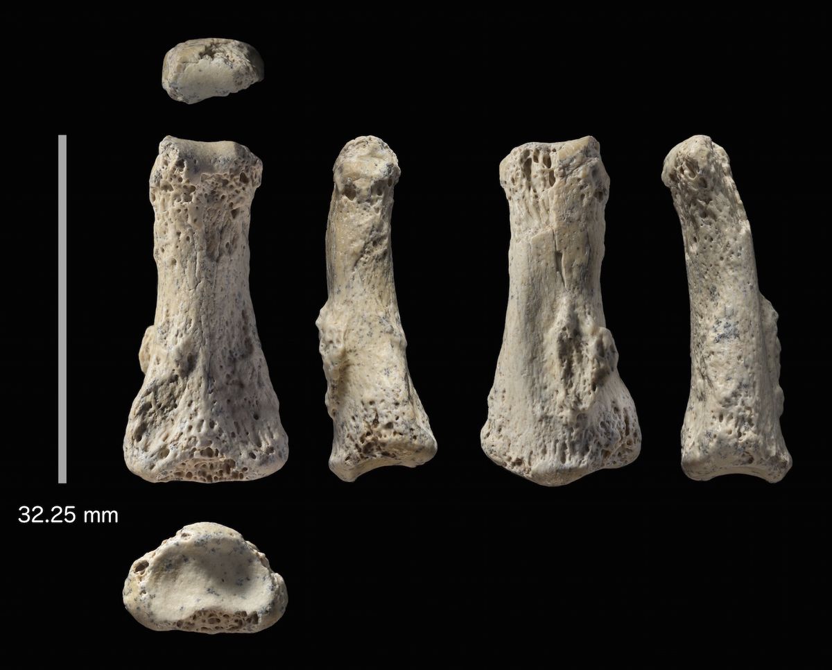 Human finger bone