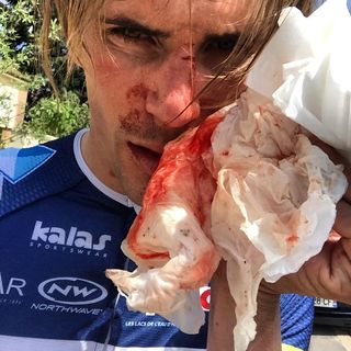 Yoann Offredo after being attacked while training
