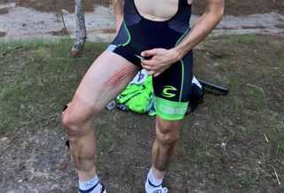 andre cardoso chainring injury