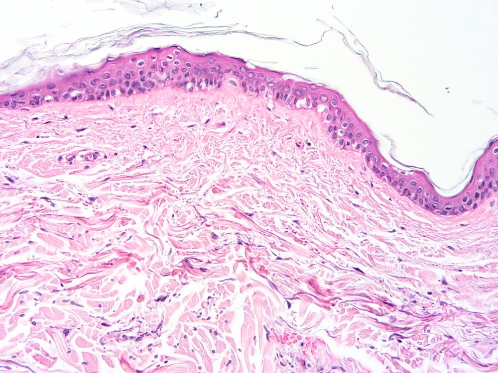 skin, histology, skin tissue