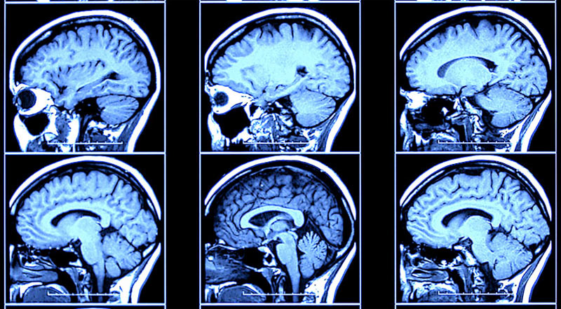 Criminal Minds Are Different From Yours, Brain Scans Reveal