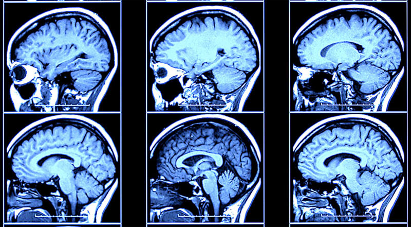 Brain self-regulation in criminal psychopaths