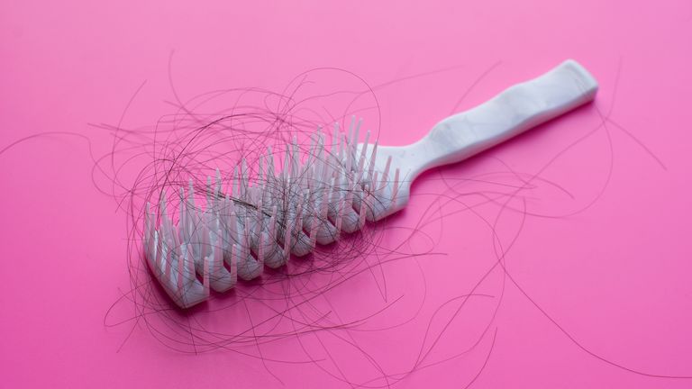 hair brush with strands on a pink background, meant to indicate hair loss; can covid cause hair loss