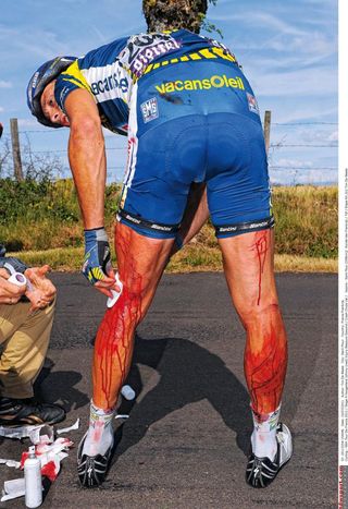 Johnny Hoogerland is seen to after his crash in the 2011 Tour de France