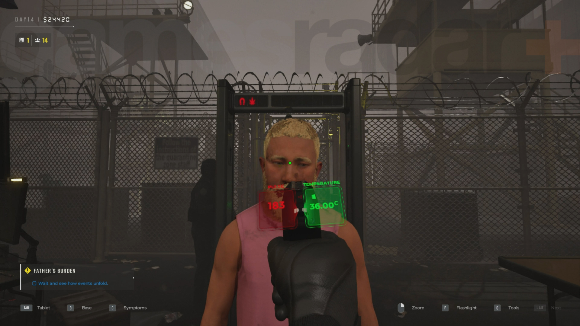 Diagnosing Quarantine Zone symptoms using the thermopulsometer