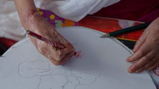 a photo of a child's hands, drawing a picture; the child has "butterfly disease" and their skin is visibly peeling and blistering
