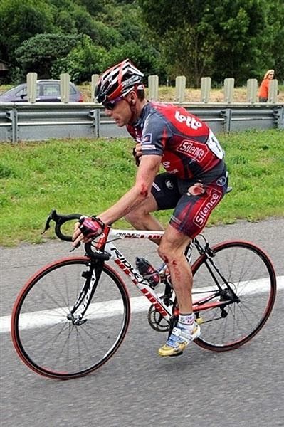 A bloody Evans radios in about his condition and tells the team management he'll be alright.