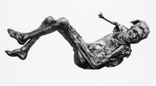 Borremose Man: This body, dating from around 840 B.C., was found preserved in a peat bog in Denmark in 1946. 