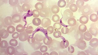 Under a magnification of 1200X, this photomicrograph of a blood sample specimen shows four flagellated Trypanosoma cruzi parasites; this life stage is referred to as trypomastigote.