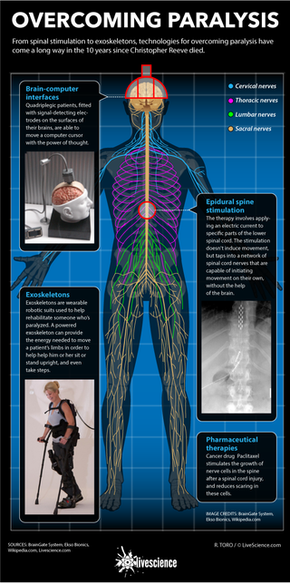 Paralysis tech infographic