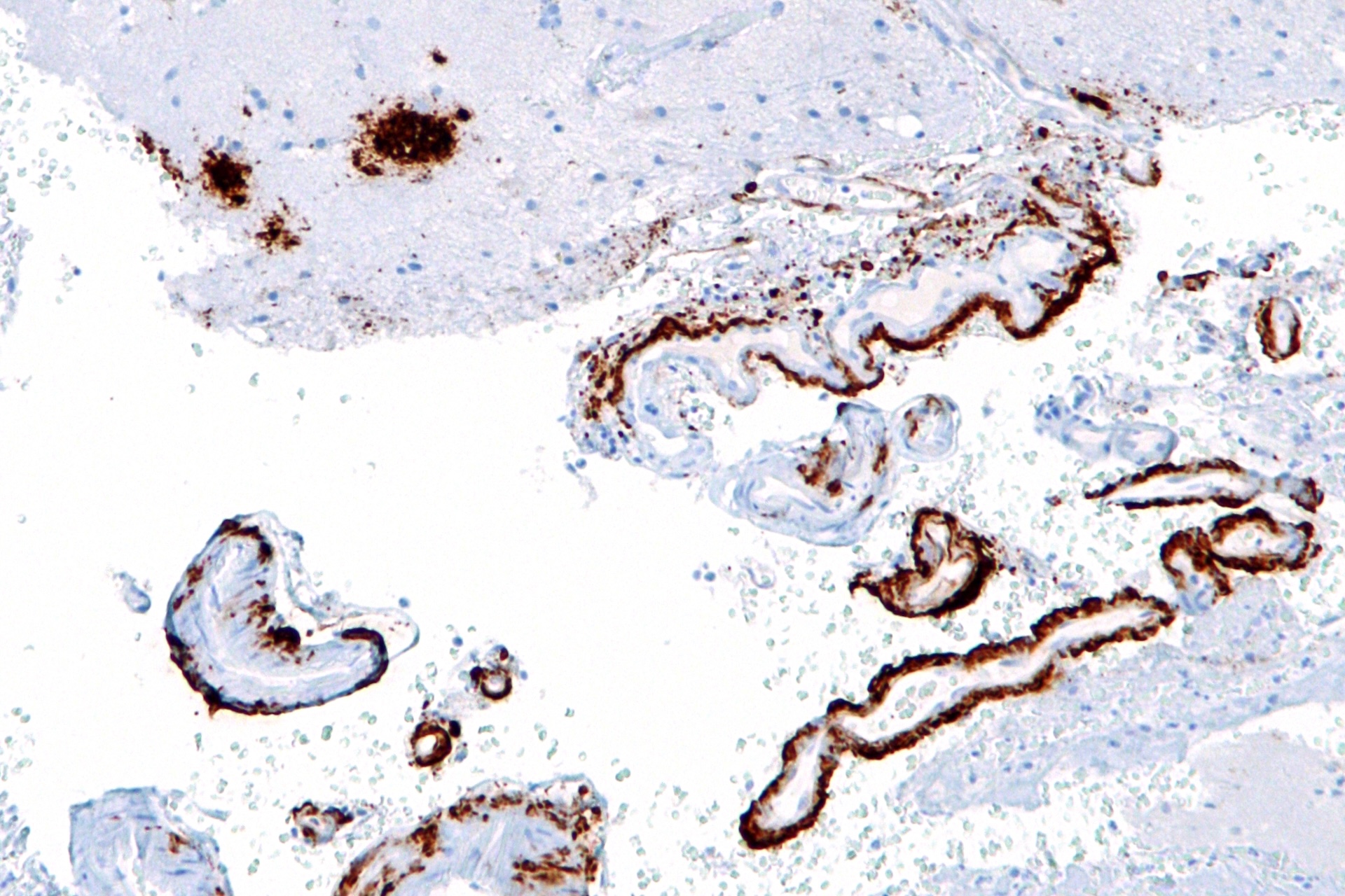 a microscope image showing brown-stained gunk built up around cels