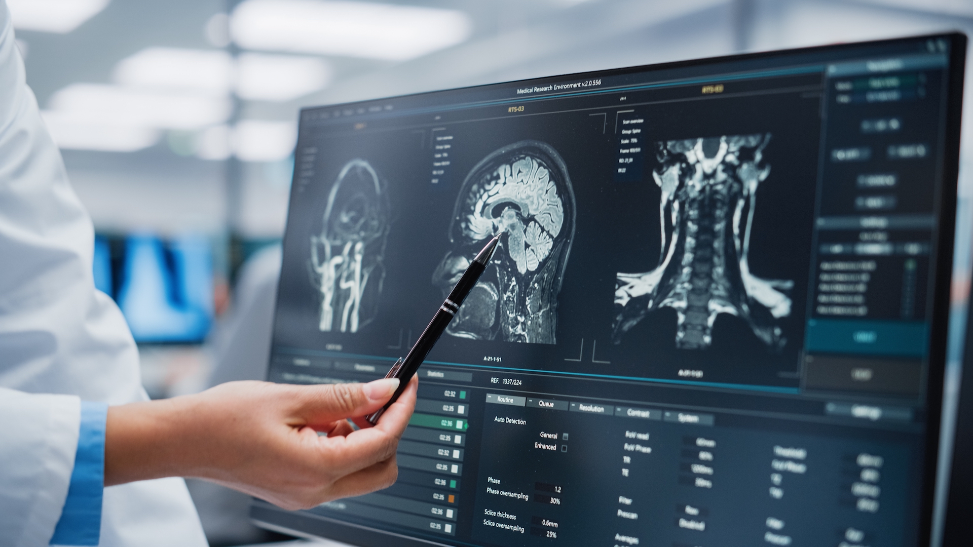 A doctor points to brain scan images on a computer screen