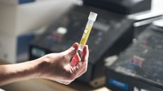 A urine collection device.