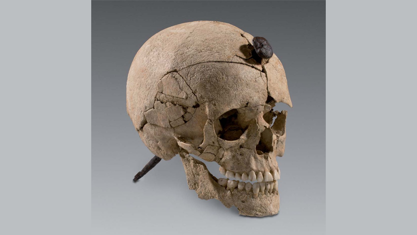 Side view of a human skeleton on a grey table. There is a large corroded iron spike running from the forehead through to the base of the skull.