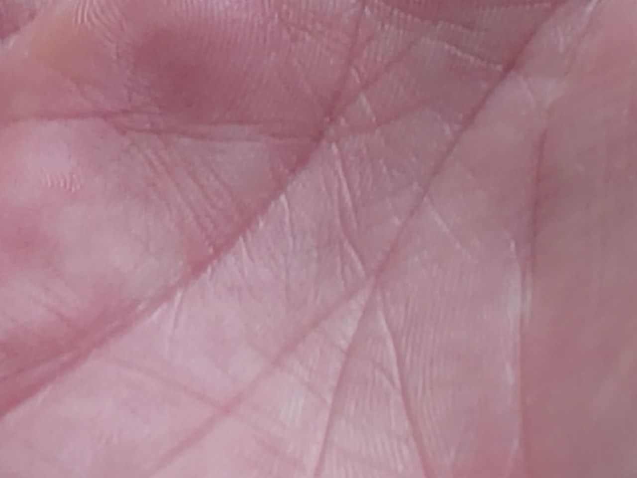 Apexel 200x smartphone micropscope sample images