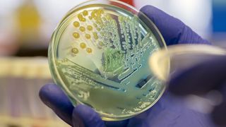 klebsiella pneumoniae growing on a clear plate, held by a hand with a surgical glove on