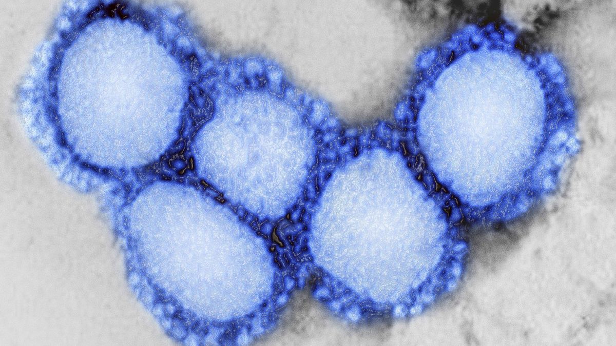 A novel coronavirus first detected in Wuhan, China, is causing the COVID-19 disease.