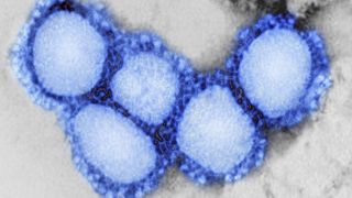 A novel coronavirus first detected in Wuhan, China, is causing the COVID-19 disease.