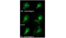 giardia