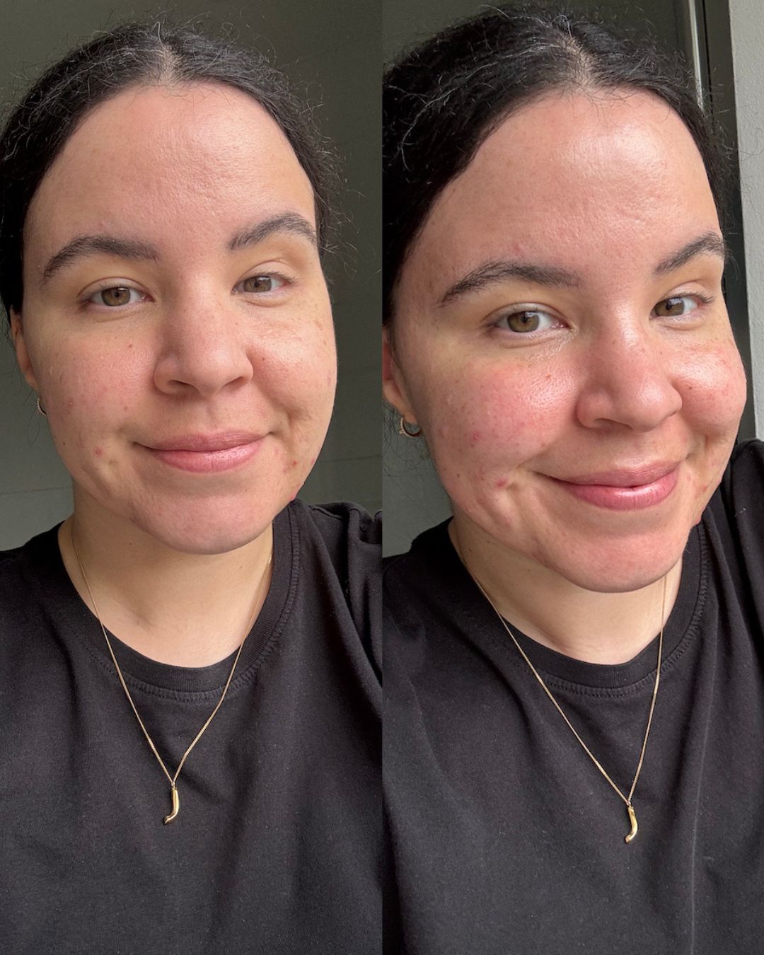 Mica Ricketts before and after using the Shark Beauty FacialPro Glow DePuffi