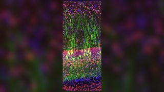 A fluorescent image of a mouse brain slice won the contest's top prize.