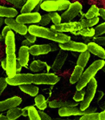 Pseudomonas aeruginosa bacterium grown onboard the space shuttle Atlantis