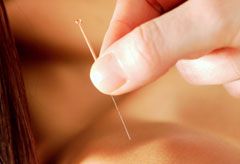 Marie Claire health news: Acupuncture