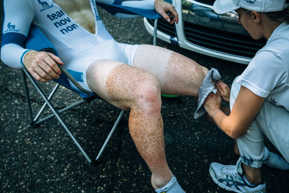 The most unique tan line and complexion awards certainly go to French rider Quentin Valgones, a new member of the Novo Nordisk team