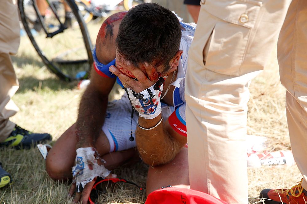William Bonnet (FDJ) cut his head but also fractured his C2 vetebrae